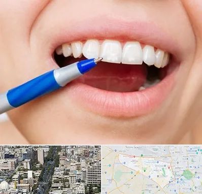 دندانسازی ارزان در منطقه 18 تهران 