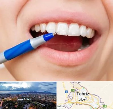 دندانسازی ارزان در تبریز