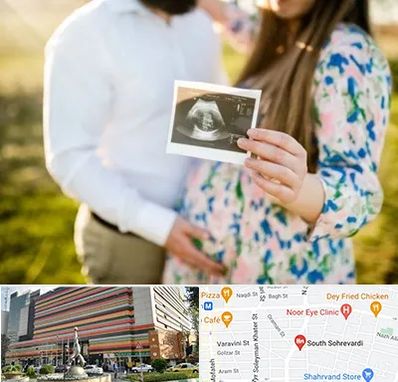 عکاسی بارداری در سهروردی 