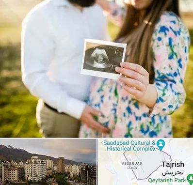 عکاسی بارداری در زعفرانیه 
