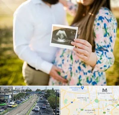 عکاسی بارداری در جنوب تهران 