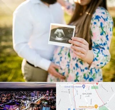 عکاسی بارداری در گلسار رشت 