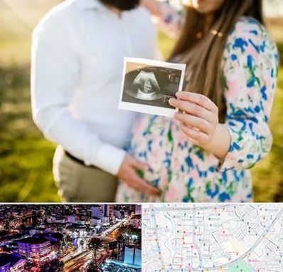 عکاسی بارداری در منظریه رشت 