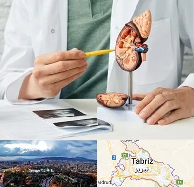 دکتر اورولوژیست در تبریز