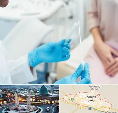 دکتر زگیل تناسلی HPV در زنجان