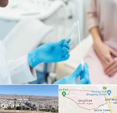دکتر زگیل تناسلی HPV در شهرک گلستان شیراز 