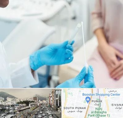 دکتر زگیل تناسلی HPV در پونک 