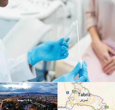 دکتر زگیل تناسلی HPV در تبریز