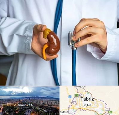 دکتر سرطان کلیه در تبریز