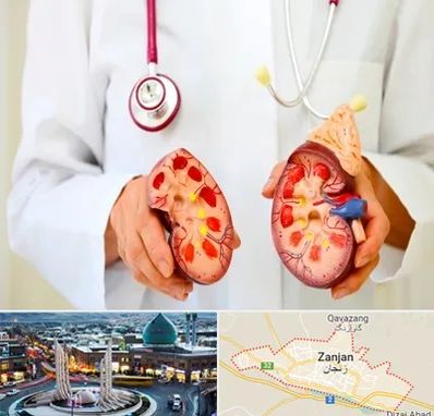 دکتر سنگ کلیه در زنجان