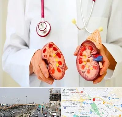 دکتر سنگ کلیه در بلوار توس مشهد 