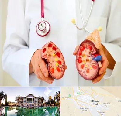 دکتر سنگ کلیه در شیراز