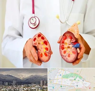 دکتر سنگ کلیه در منطقه 4 تهران 