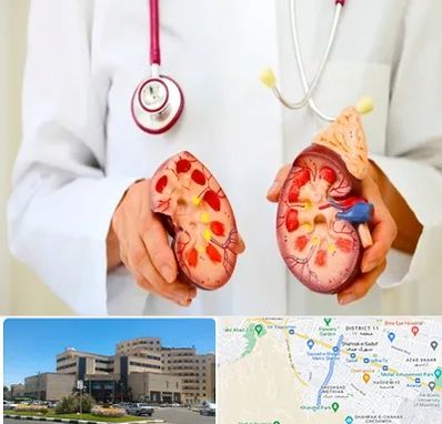 دکتر سنگ کلیه در صیاد شیرازی مشهد 