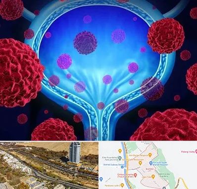 دکتر سرطان مثانه در خیابان نیایش شیراز 