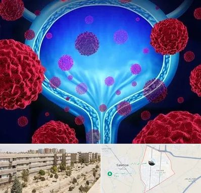 دکتر سرطان مثانه در واوان اسلامشهر