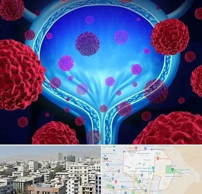 دکتر سرطان مثانه در منطقه 14 تهران 