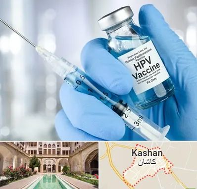 واکسن گارداسیل در کاشان