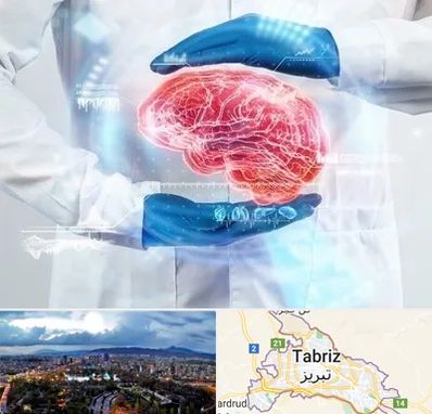 دکتر مغز و اعصاب در تبریز