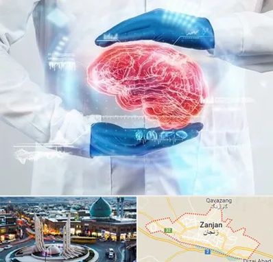 دکتر مغز و اعصاب در زنجان