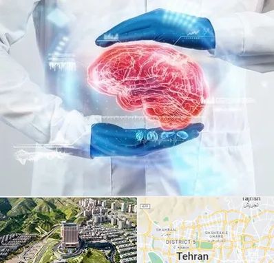 دکتر مغز و اعصاب در شمال تهران 
