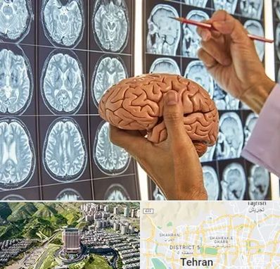 جراح مغز و اعصاب در شمال تهران 