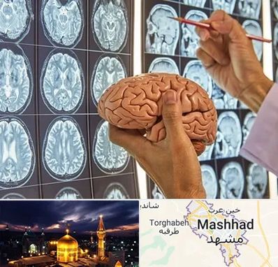 جراح مغز و اعصاب در مشهد