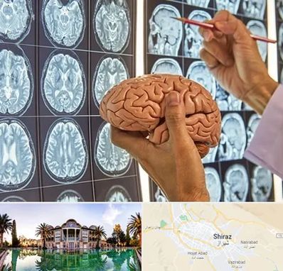 جراح مغز و اعصاب در شیراز