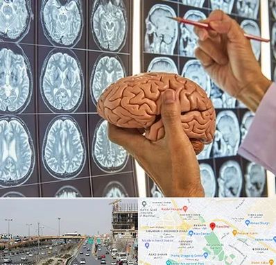 جراح مغز و اعصاب در بلوار توس مشهد 