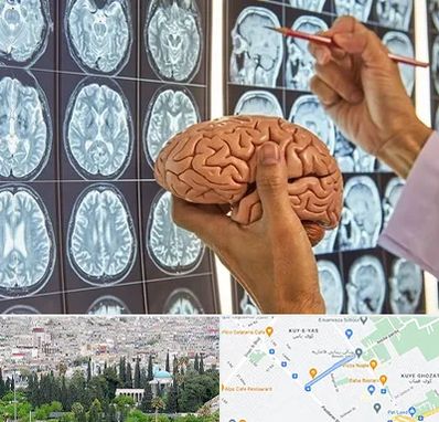 دکتر فوق تخصص جراح مغز و اعصاب در محلاتی شیراز 