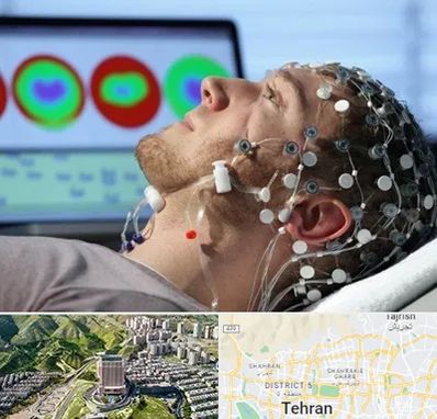 مرکز نوار مغز در شمال تهران 