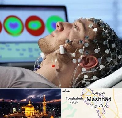 مرکز نوار مغز در مشهد