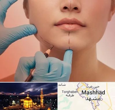 دکتر زیبایی خانم در مشهد