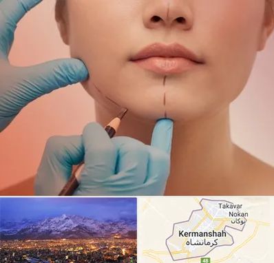 دکتر زیبایی خانم در کرمانشاه