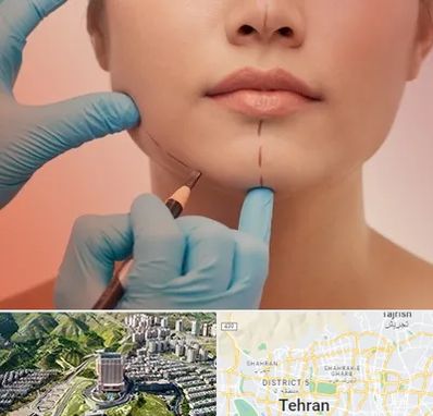 دکتر زیبایی خانم در شمال تهران 