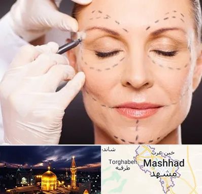 دکتر زیبایی صورت در مشهد