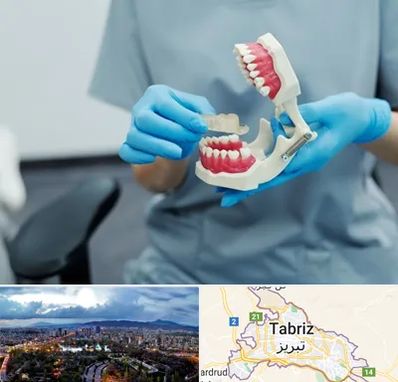 دندانپزشک خانم در تبریز