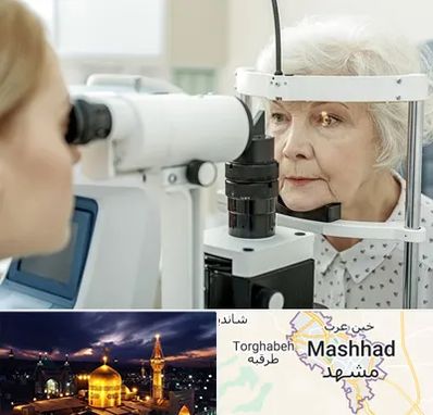 چشم پزشک خانم در مشهد