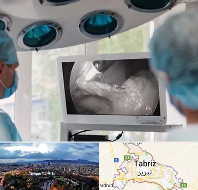 جراح ریه در تبریز