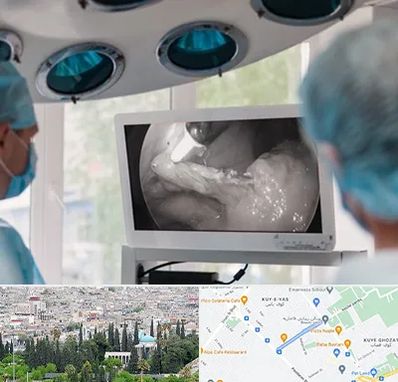 جراح ریه در محلاتی شیراز 