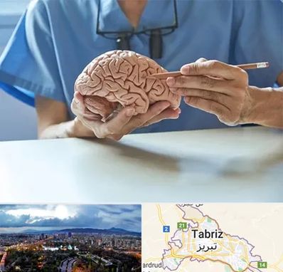 دکتر نورولوژی در تبریز