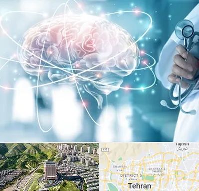 دکتر سکته مغزی در شمال تهران 