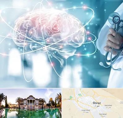 دکتر سکته مغزی در شیراز