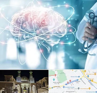 دکتر سکته مغزی در زرگری شیراز 