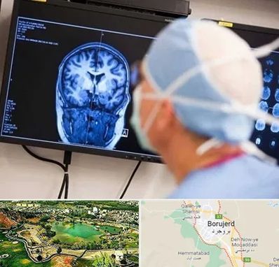 دکتر مغز و اعصاب کودکان در بروجرد