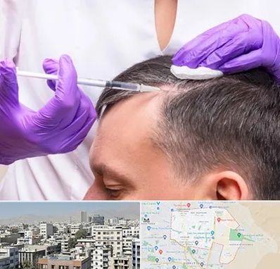 دکتر فوق تخصص پوست و مو در منطقه 14 تهران 