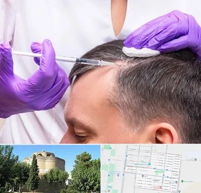 دکتر فوق تخصص پوست و مو در مرداویج اصفهان 