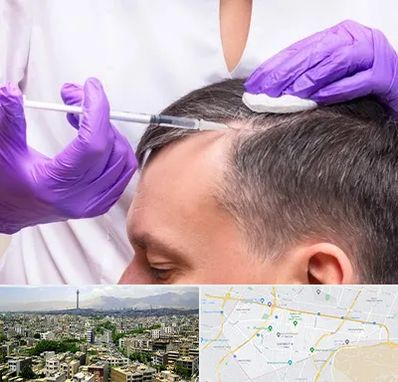 دکتر فوق تخصص پوست و مو در منطقه 8 تهران 