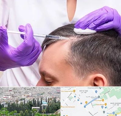 دکتر فوق تخصص پوست و مو در محلاتی شیراز 