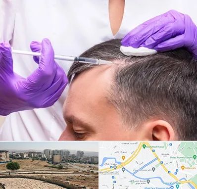 دکتر فوق تخصص پوست و مو در کوی وحدت شیراز 